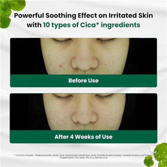 Dr.G Red Blemish Clear Soothing Cream, 70ml - Moisturizing Recovery Cream for - Picture 3 of 7